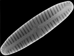 Encyonema appalachianum, a new species of diatom from western Pennsylvania discovered by Marina Potapova in 2014
