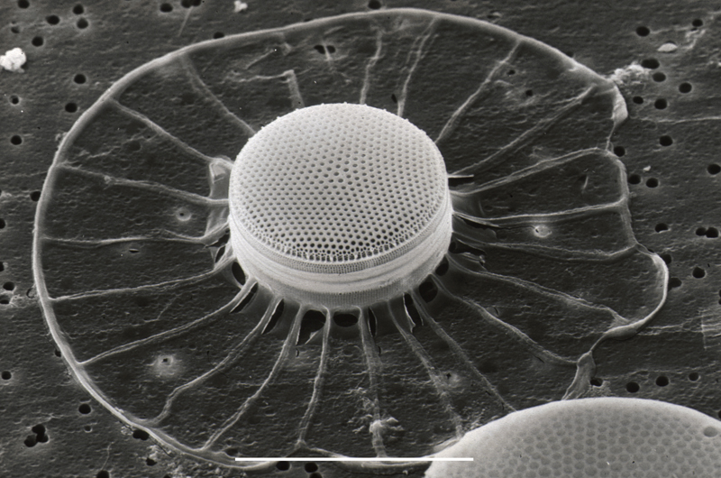 Diatoms indicate water nutrient levels.