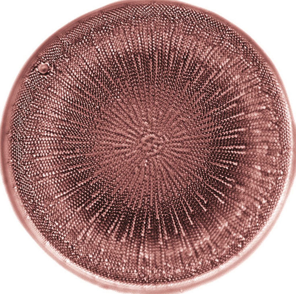 round pink diatom